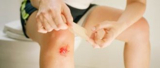 Sick leave for an industrial injury: how it is paid and processed