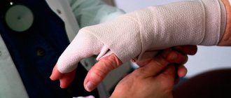Work injury